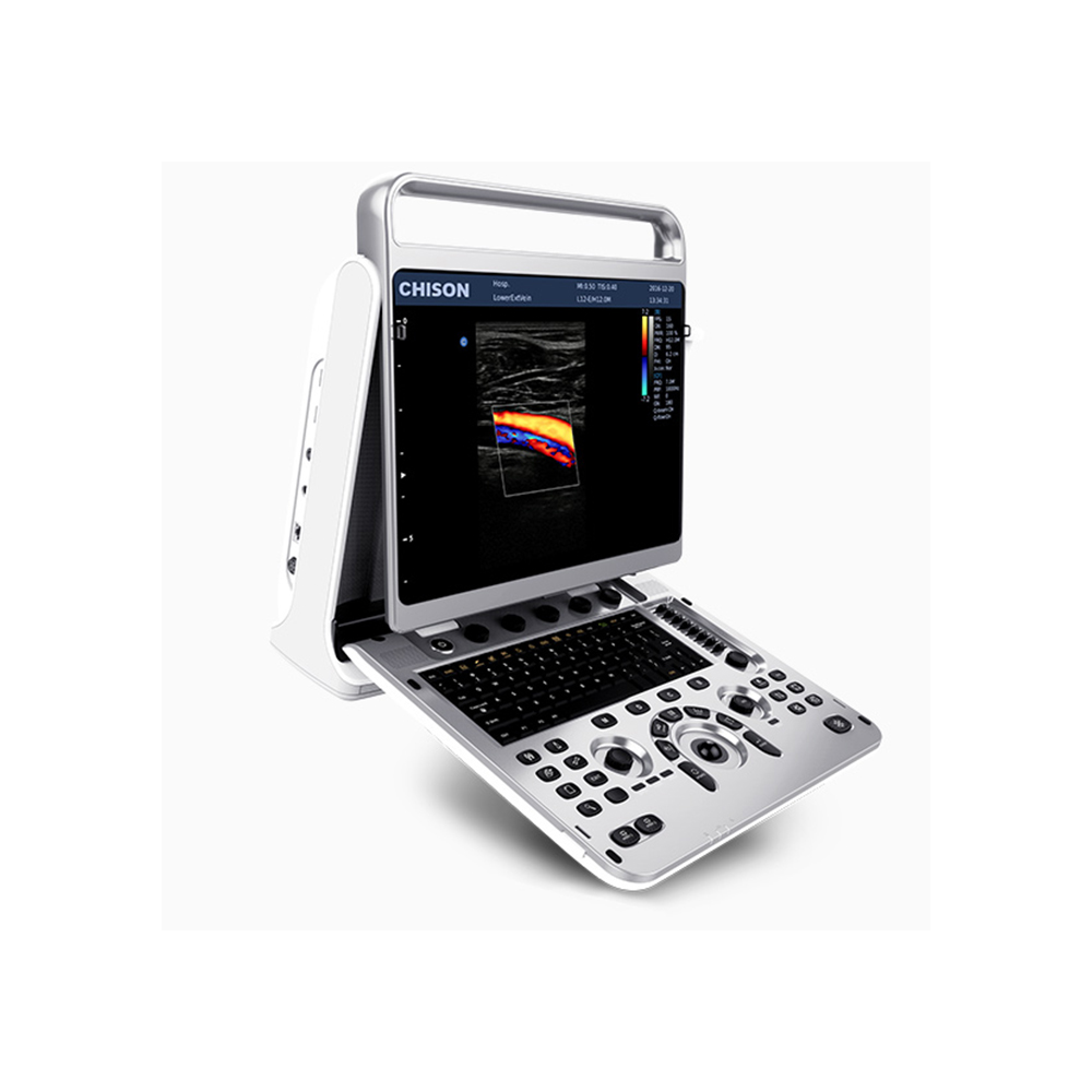 CHISON EBIT 20 VET COLOR DOPPLER ULTRASON CIHAZI