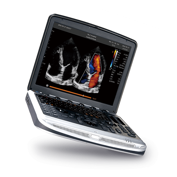 CHİSON SONOBOOK7 VET COLOR DOPPLER ULTRASON CİHAZI