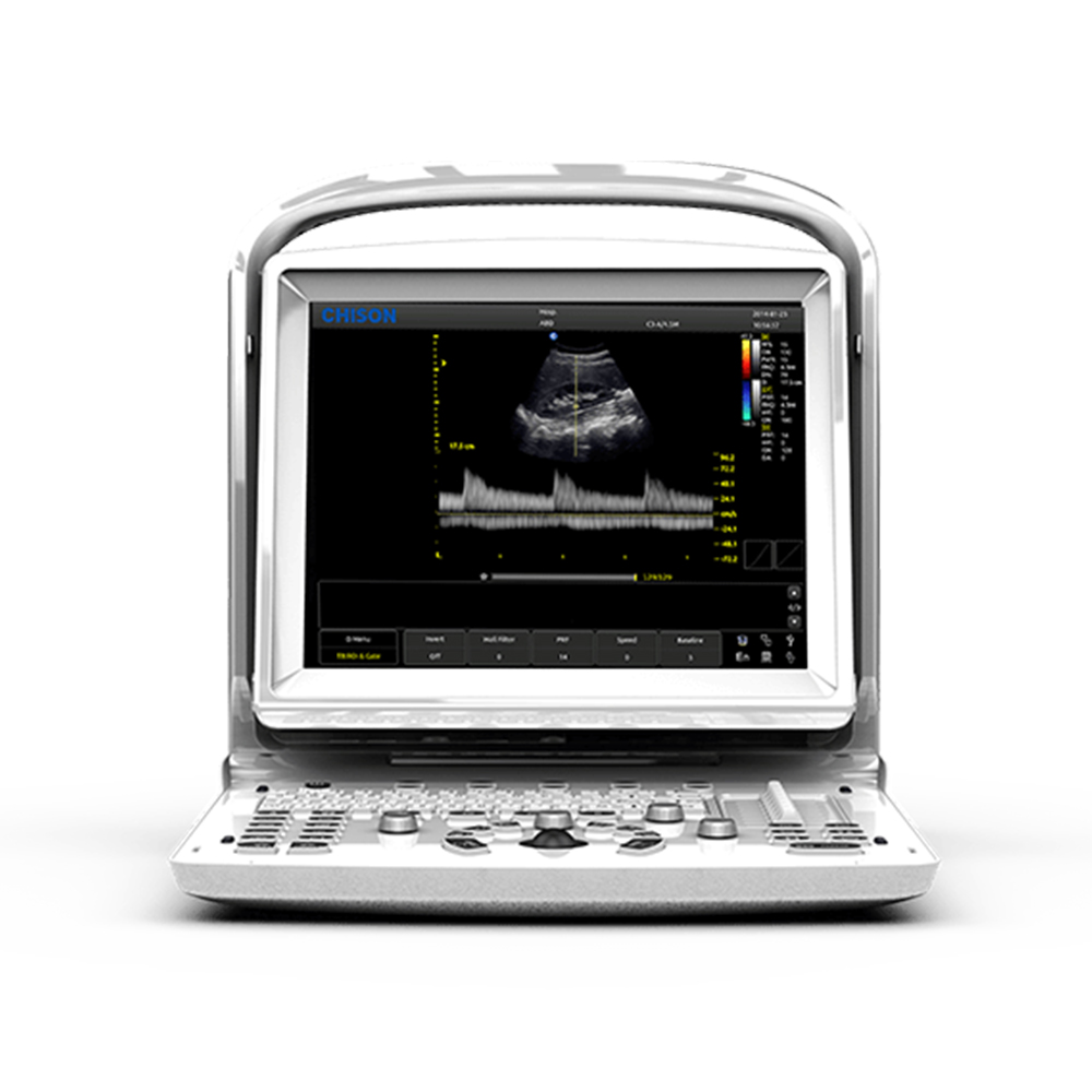 CHİSON ECO3 EXPERT VET DOPPLER ULTRASON CİHAZI